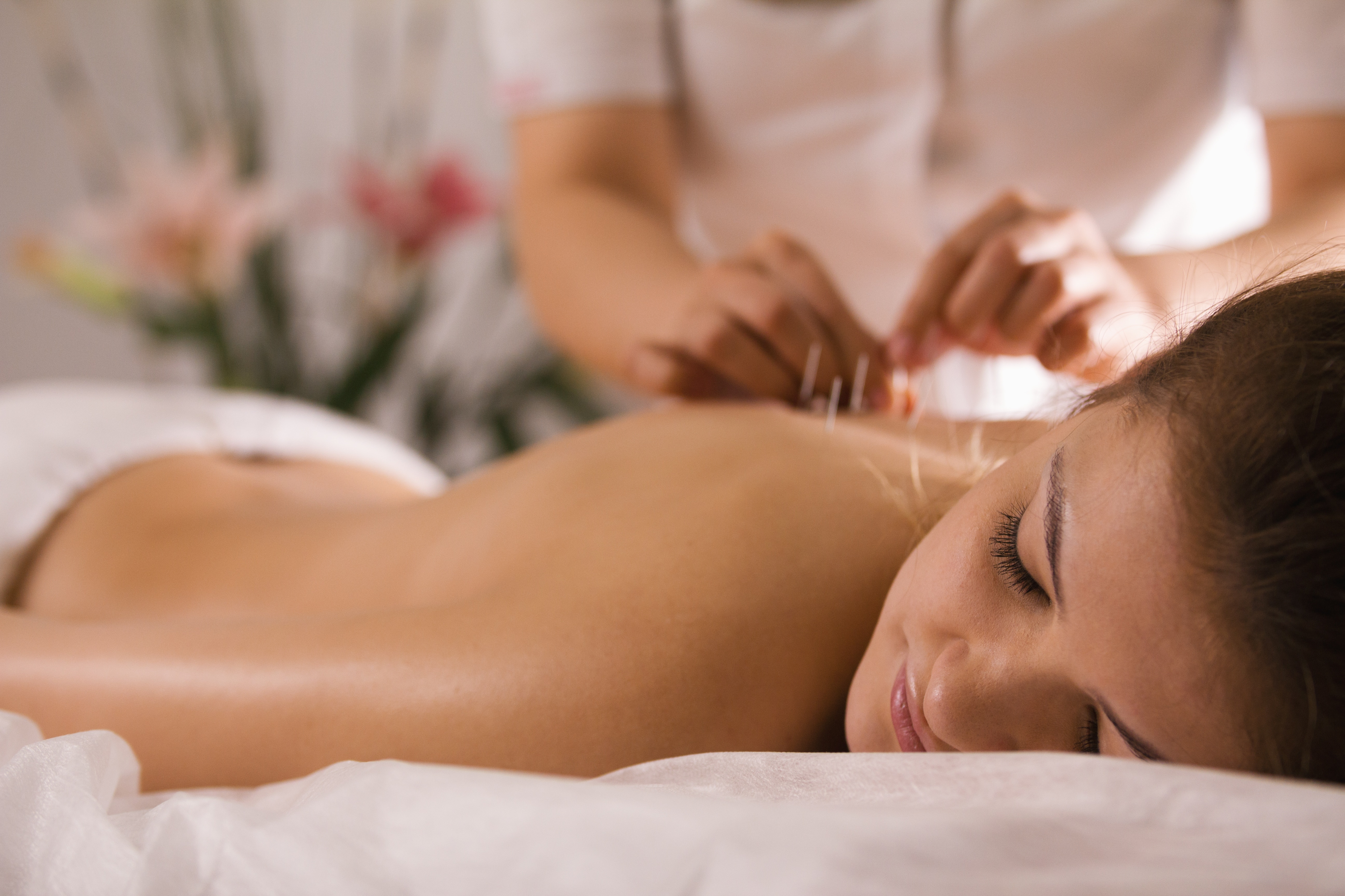 The doctor sticks needles into the woman's body on the acupuncture - close up